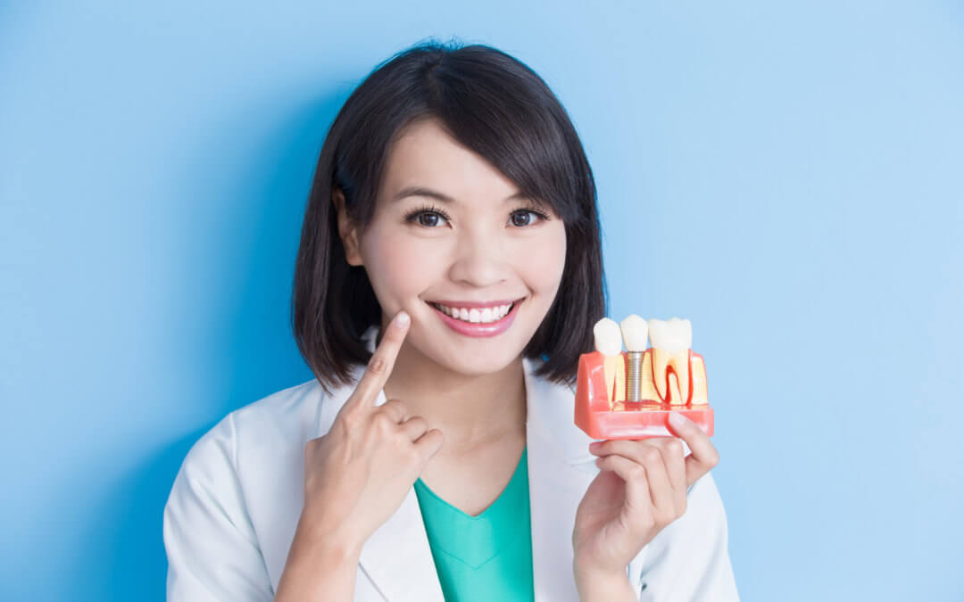 The Types of Dental Implants: Your Options Explained