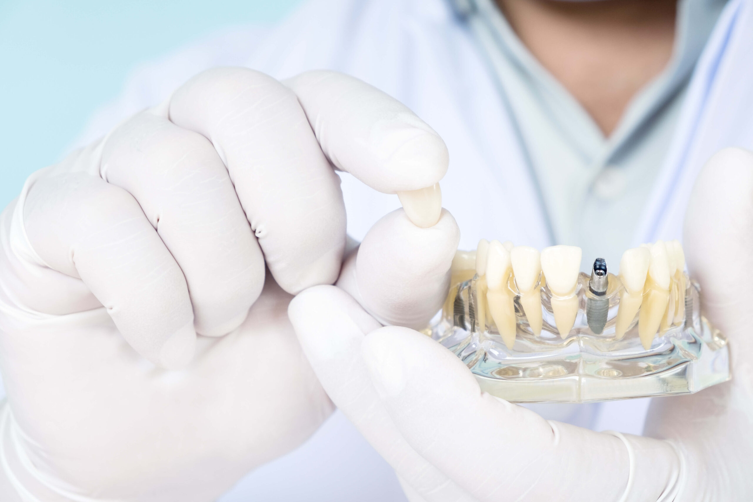 Dental Implants in Utah A Comprehensive Guide Utah Oral Surgeons